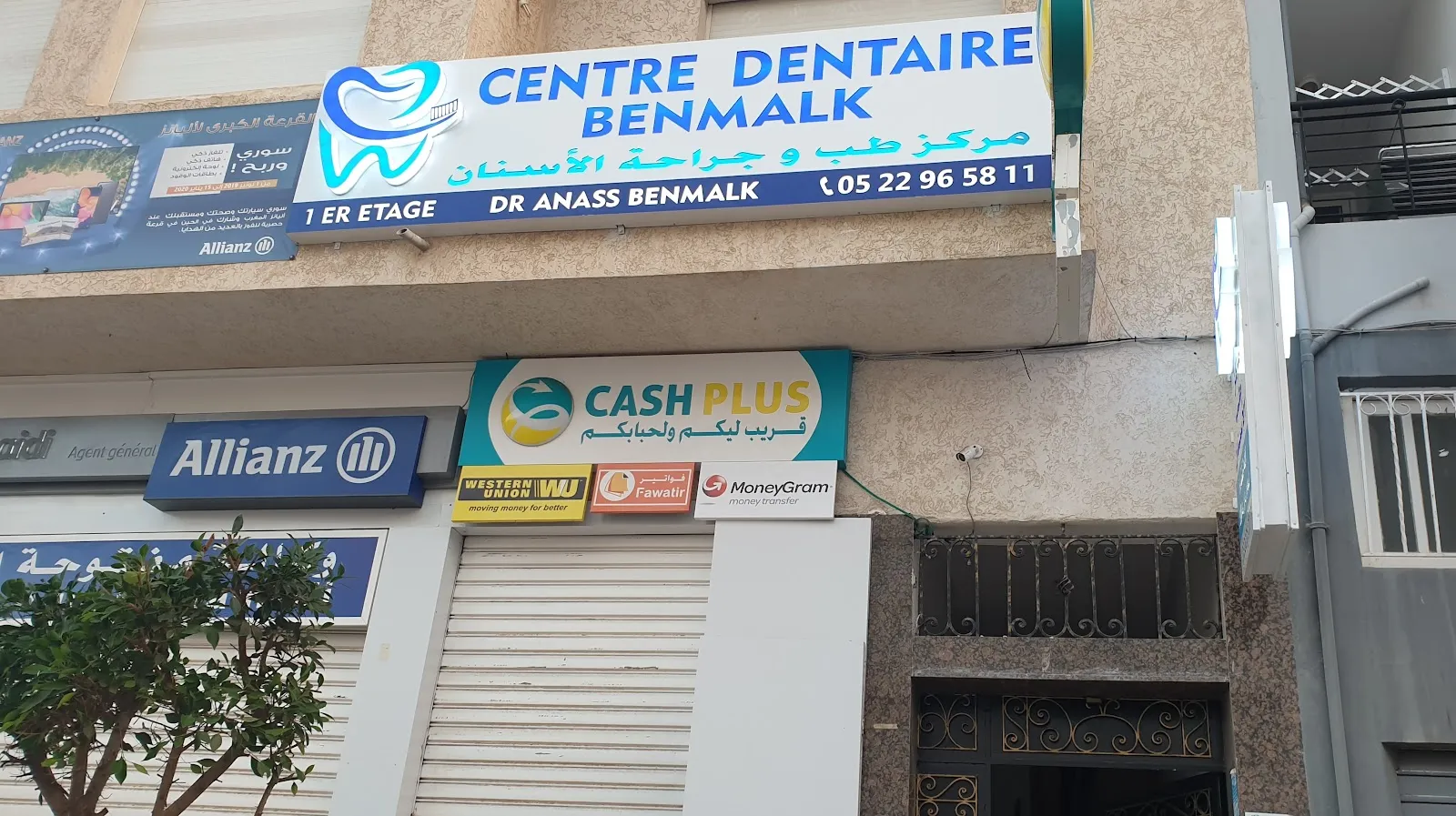CENTRE DENTAIRE BENMALK // Dr BENMALK Anass // Chirurgien dentiste//Implantologue//Orthodontiste